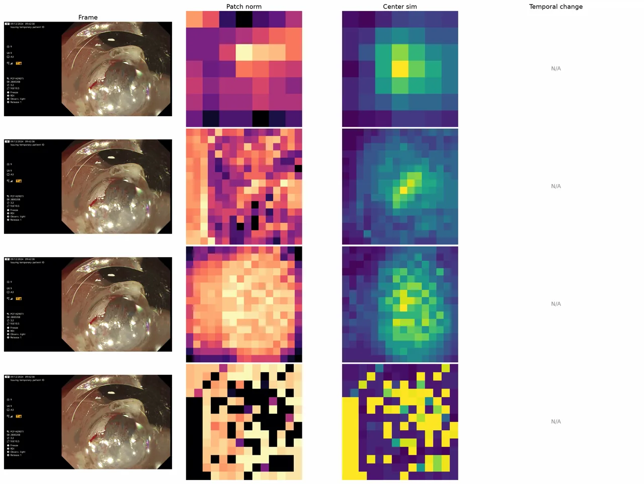 Endoscopic frames beside DINOv2 patch-norm and centre-similarity maps through an ESD sequence.