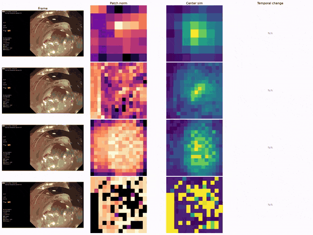 Endoscopic frames beside DINOv2 patch-norm and centre-similarity maps through an ESD sequence.